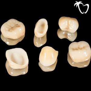 Porcelain Crowns in Cancun