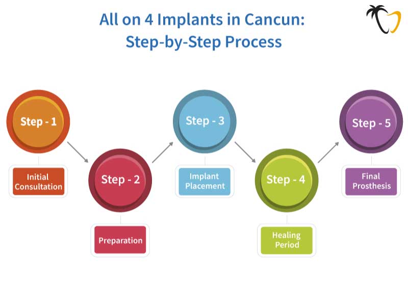 All on 4 Dental Implants Procedure in Cancun