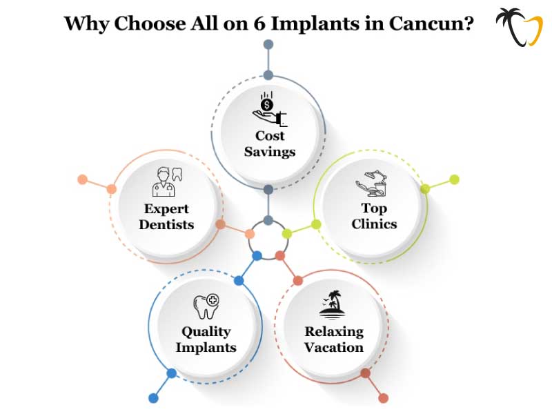 Benefits of Choosing Cancun for All on 6 Implants